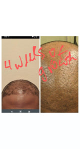 Wholesale/Private Label Organic Herbal Hair Growth Oil