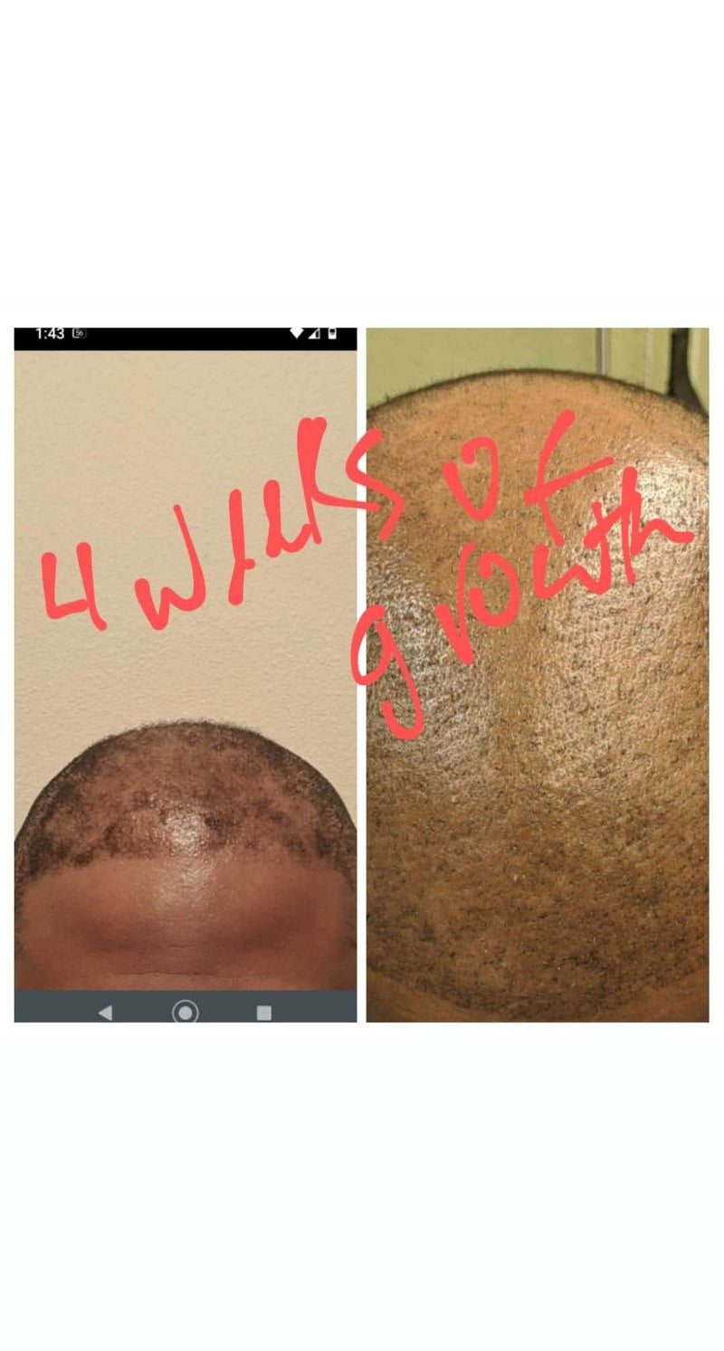 Wholesale/Private Label Organic Herbal Hair Growth Oil